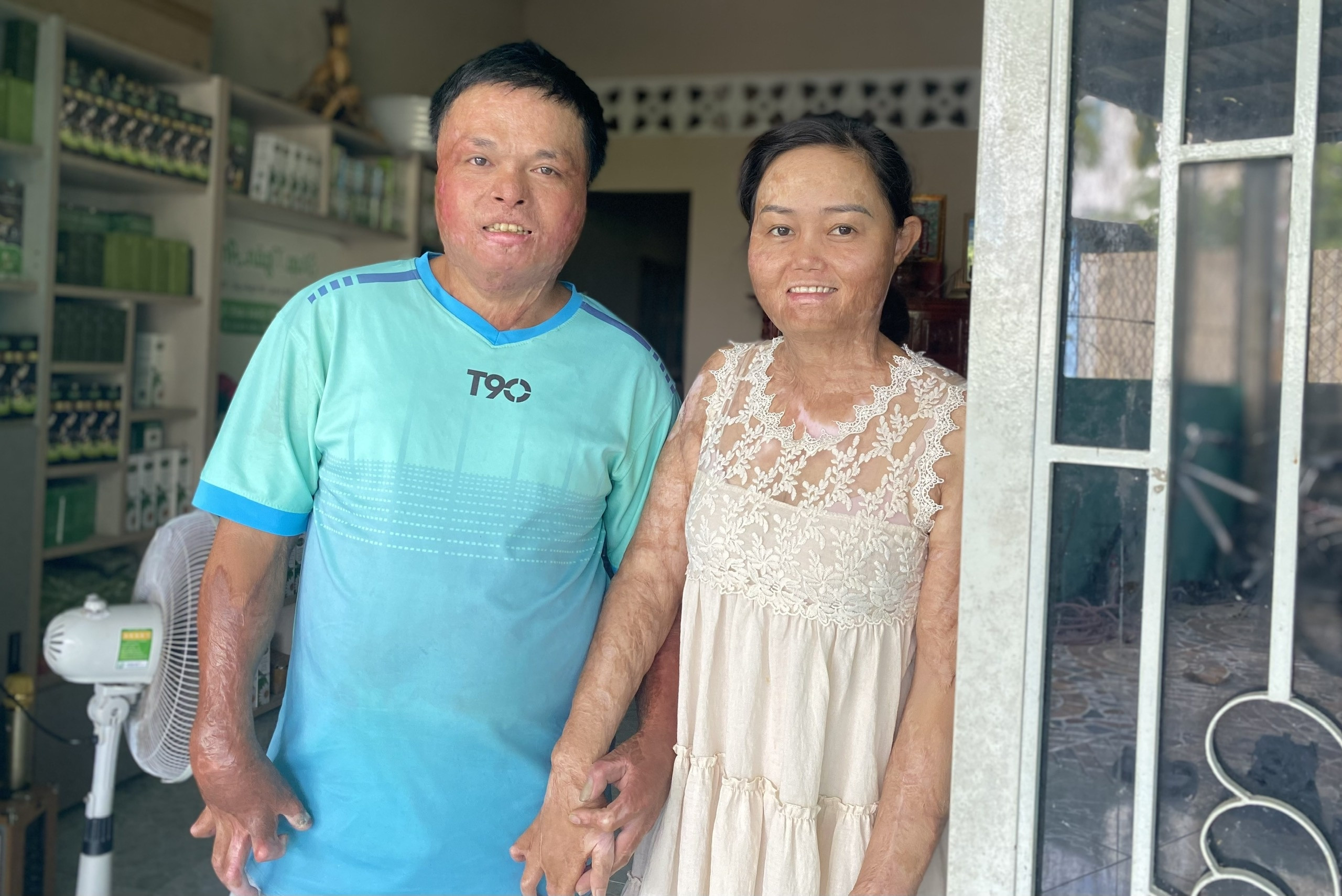 bi chong thieu song anh 1