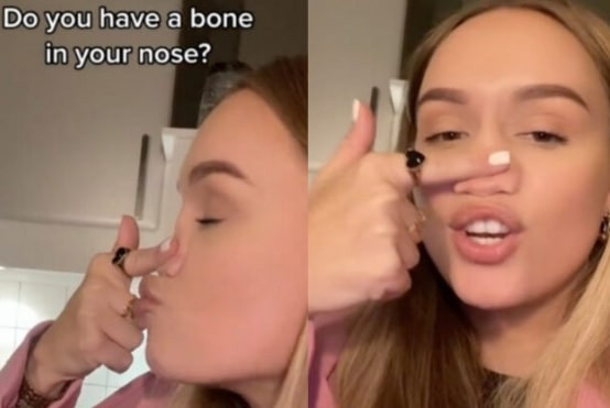 Sinh ra đã không có xương mũi, cô gái trở thành hiện tượng trên mạng xã hội