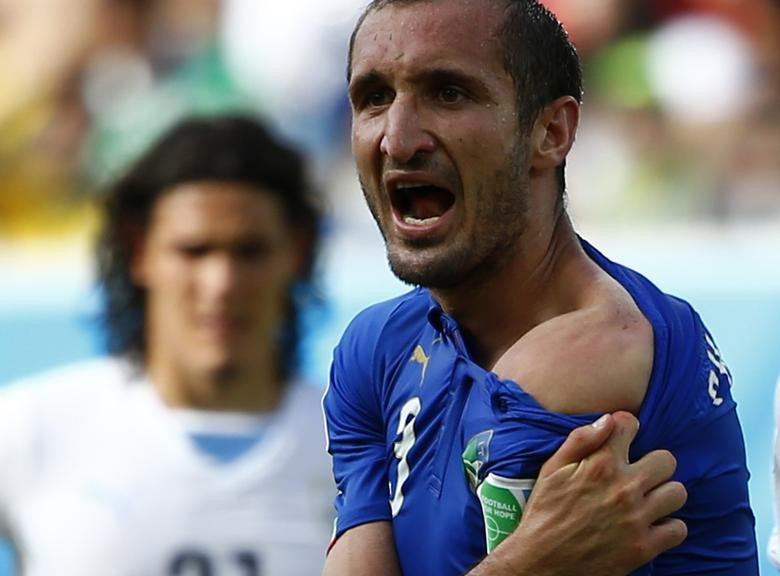 Giorgio Chiellini của Italy khoe vai, cho rằng anh bị Luis Suarez của Uruguay cắn, trong trận đấu bảng D năm 2014.