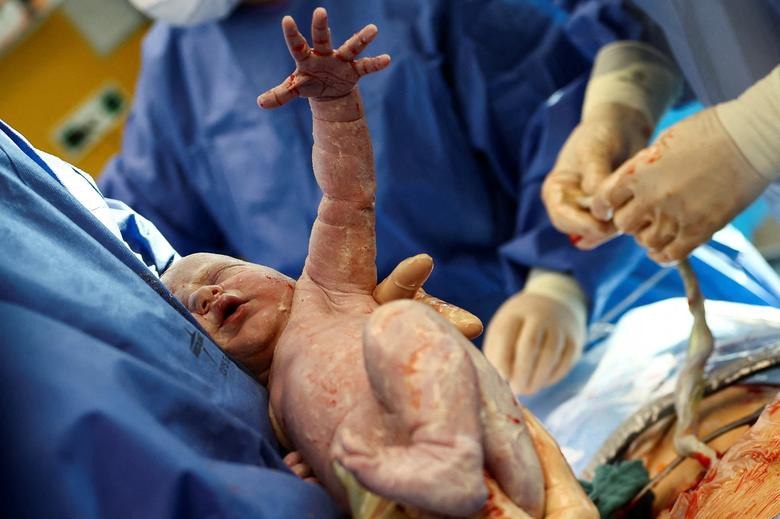 Một đứa trẻ sơ sinh tên Elias được sinh tại bệnh viện Charite (Đức), khi dân số thế giới sắp đạt 8 tỷ người.