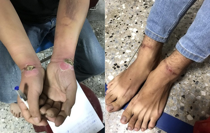 'Nữ quái' 19 tuổi cầm đầu băng nhóm lừa đảo, bắt cóc đòi tiền chuộc