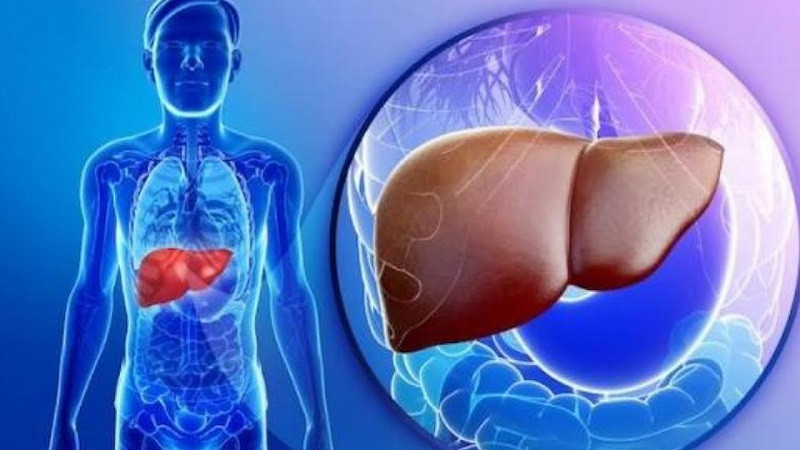 Bị táo bón lại đi thải độc, đi khám bị ung thư di căn toàn ổ bụng