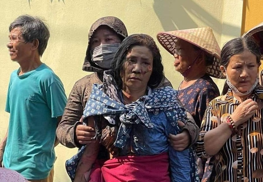 Khởi tố vụ 3 con gái mang xăng đốt nhà mẹ đẻ: 3 con có thể phạm tội gì, án phạt ra sao?