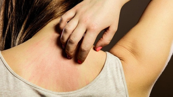 10 dấu hiệu cho thấy cơ thể bạn đang chứa độc tố