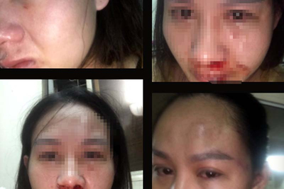 Hà Nội: Một cán bộ công an bị 'tố' hành hung vợ con