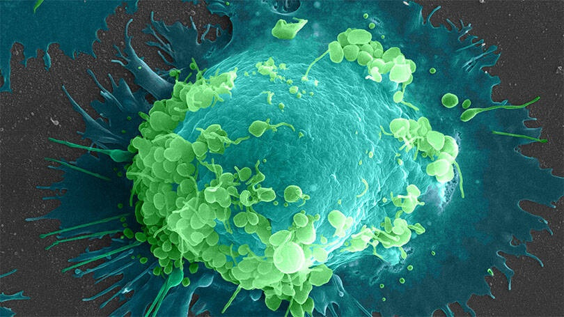 Một phần mỏng của tế bào máu đại thực bào trong phổi chuột. Đại thực bào là một loại tế bào bạch cầu giúp loại bỏ các chất lạ.