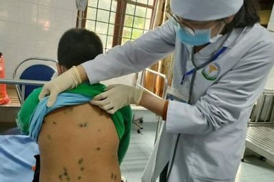 Hai loại bệnh truyền nhiễm tấn công nhiều trẻ em Hà Nội và các tỉnh phía Bắc