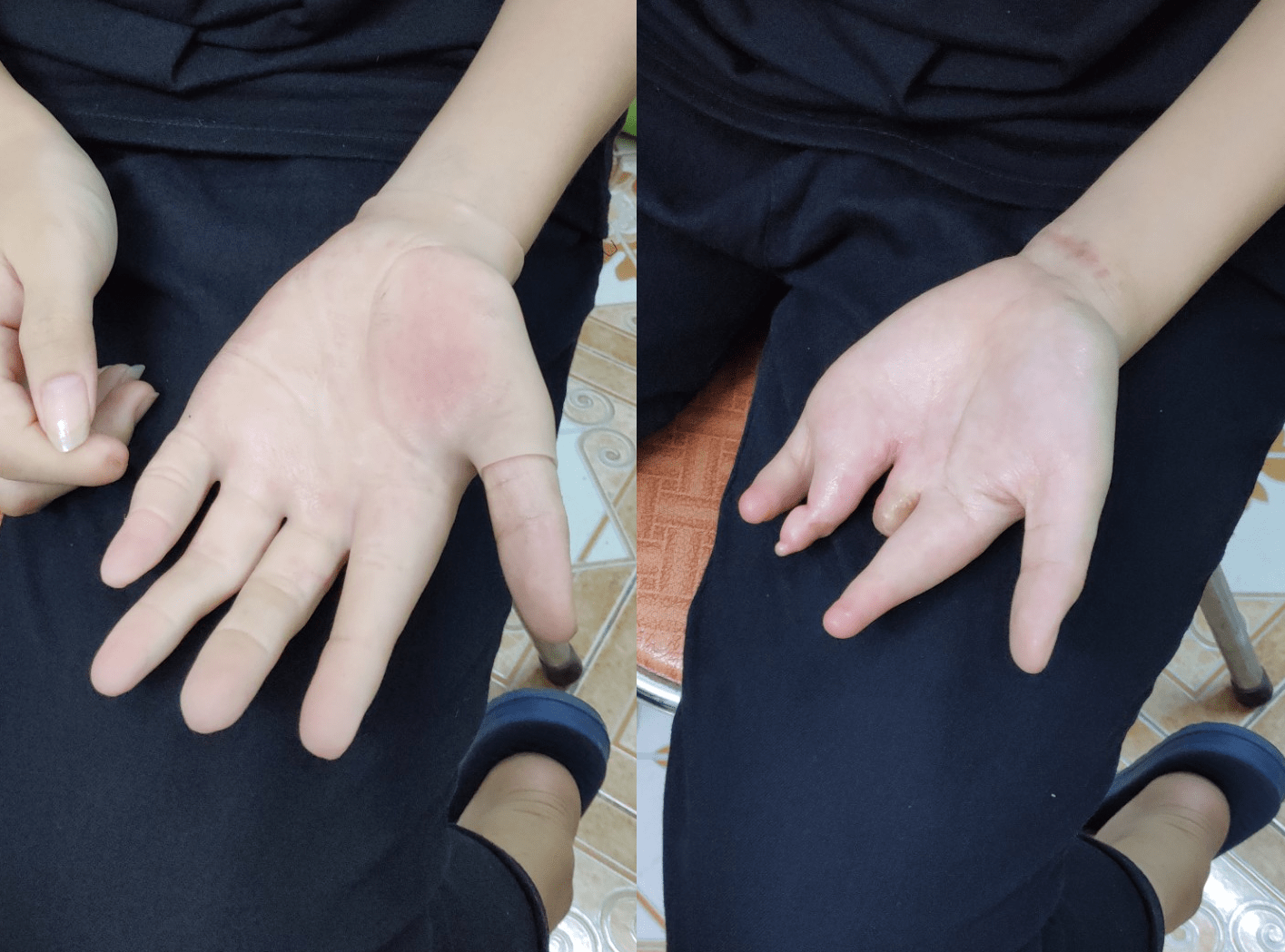 Đôi bạn Hà thành 'biến silicon thành da thịt' cho người khiếm khuyết - 3