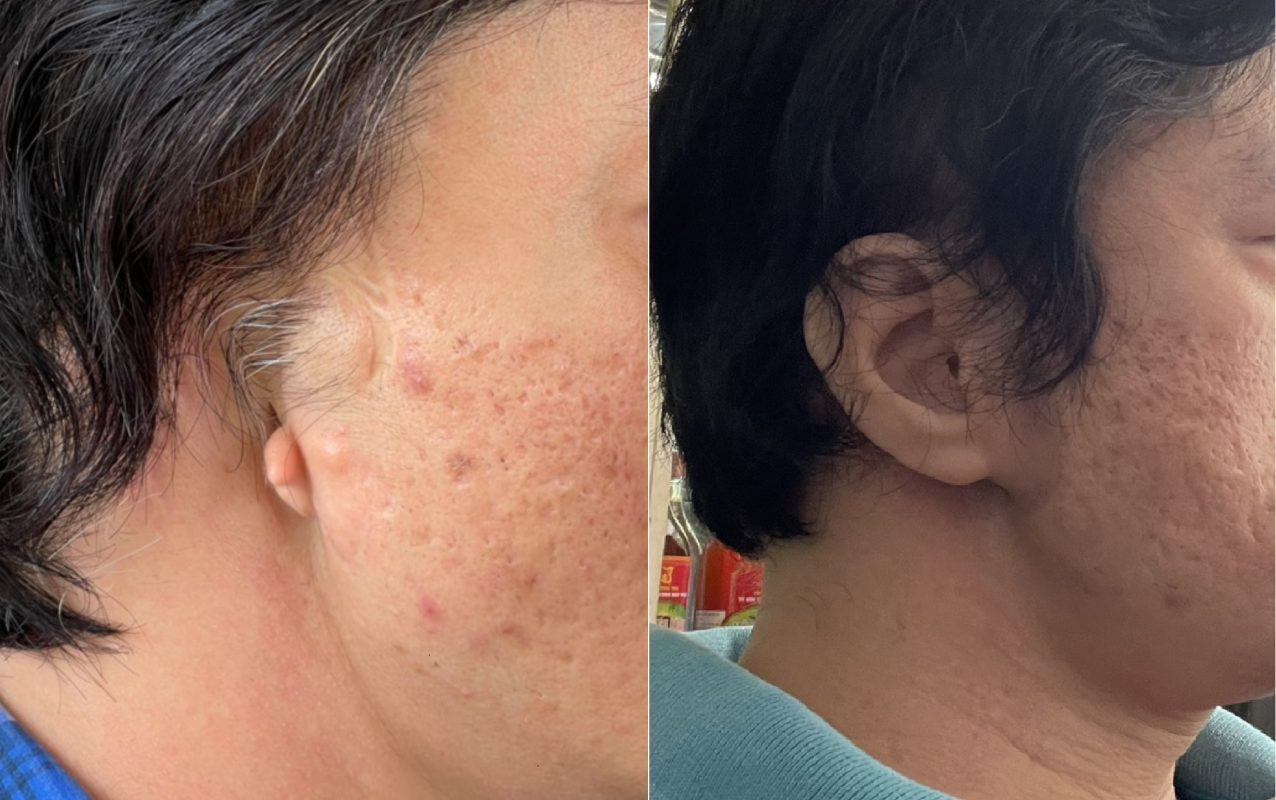 Đôi bạn Hà thành 'biến silicon thành da thịt' cho người khiếm khuyết - 6