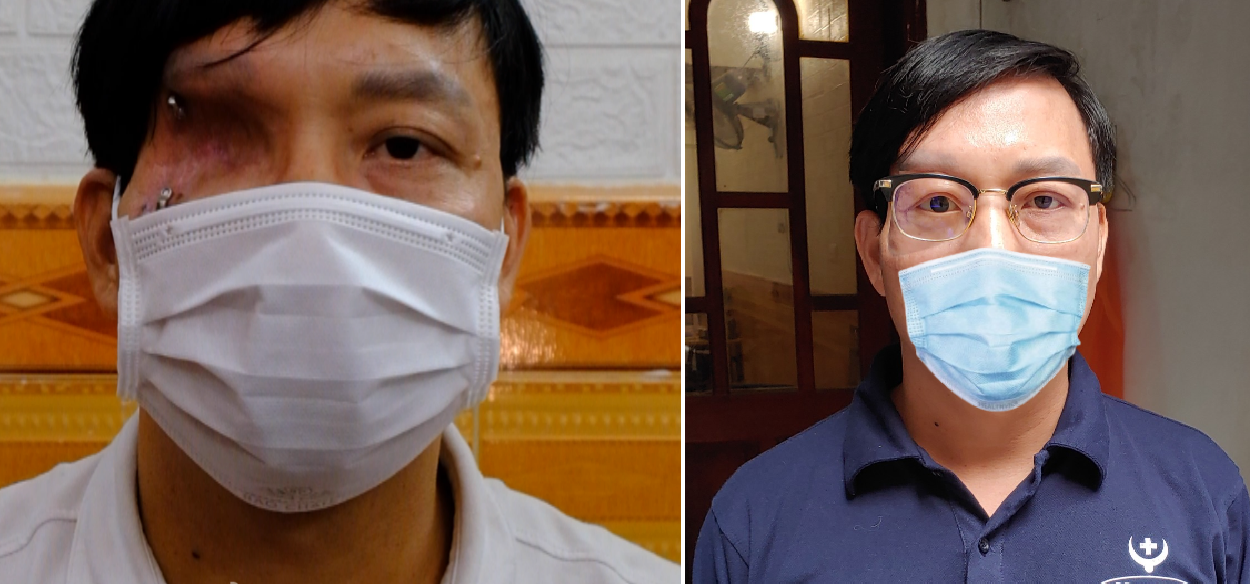 Đôi bạn Hà thành 'biến silicon thành da thịt' cho người khiếm khuyết - 7