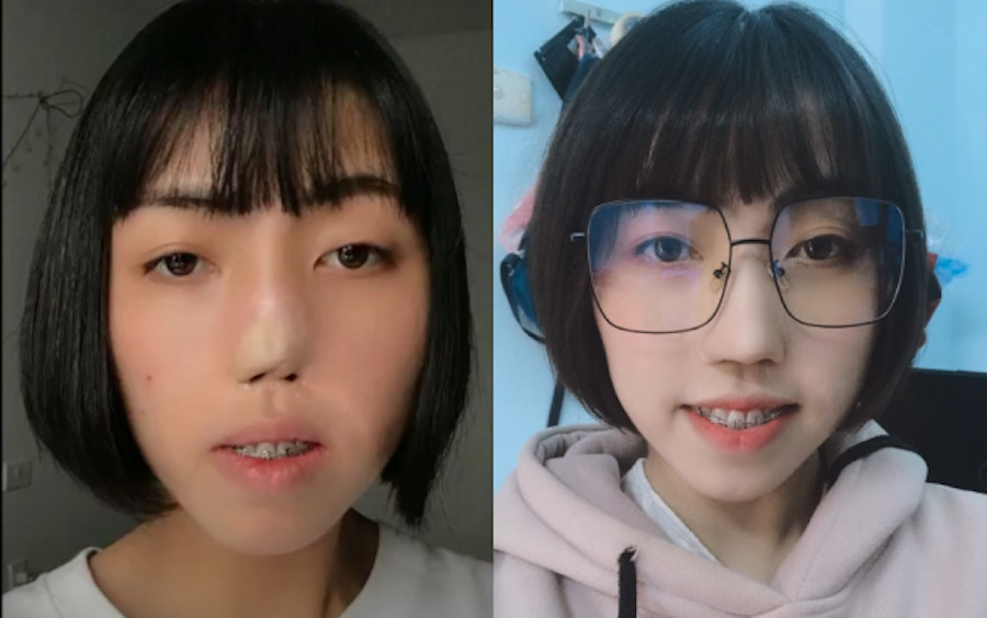 Đôi bạn Hà thành 'biến silicon thành da thịt' cho người khiếm khuyết - 2