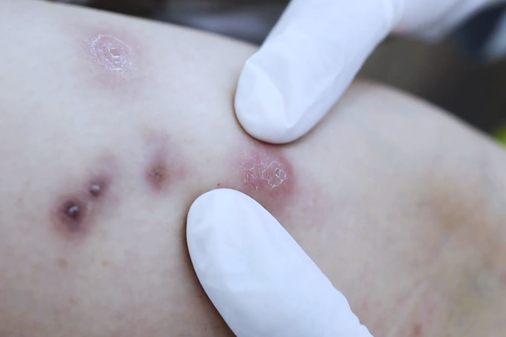 Tiêm tan mỡ, nhiều người trả giá đắt - Ảnh 2.