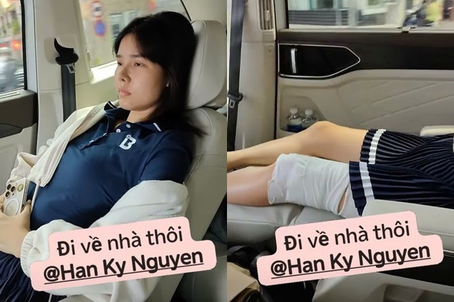 Vợ Mạc Hồng Quân catwalk trở lại sau 6 tháng gãy đùi bị soi đôi chân con rết kém thẩm mỹ