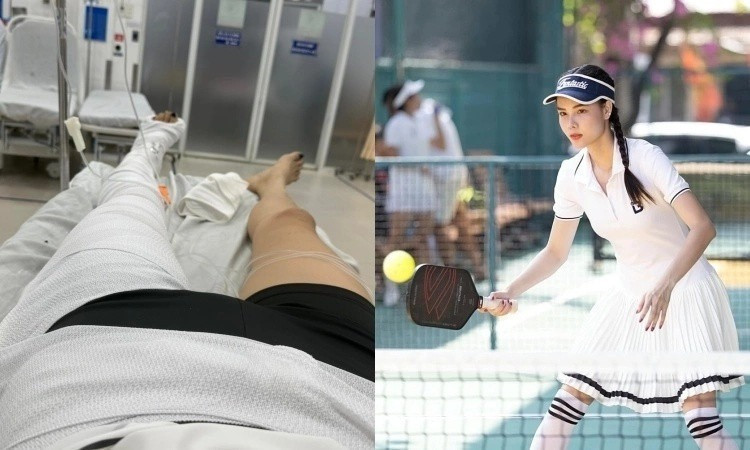 Vợ Mạc Hồng Quân catwalk trở lại sau 6 tháng gãy đùi bị soi đôi chân con rết kém thẩm mỹ