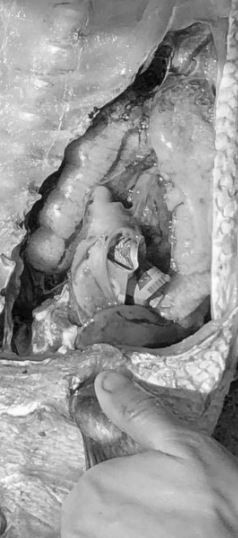 Mổ bụng cá, ngư dân sốc nặng khi phát hiện tiền mặt bên trong - Ảnh 1.