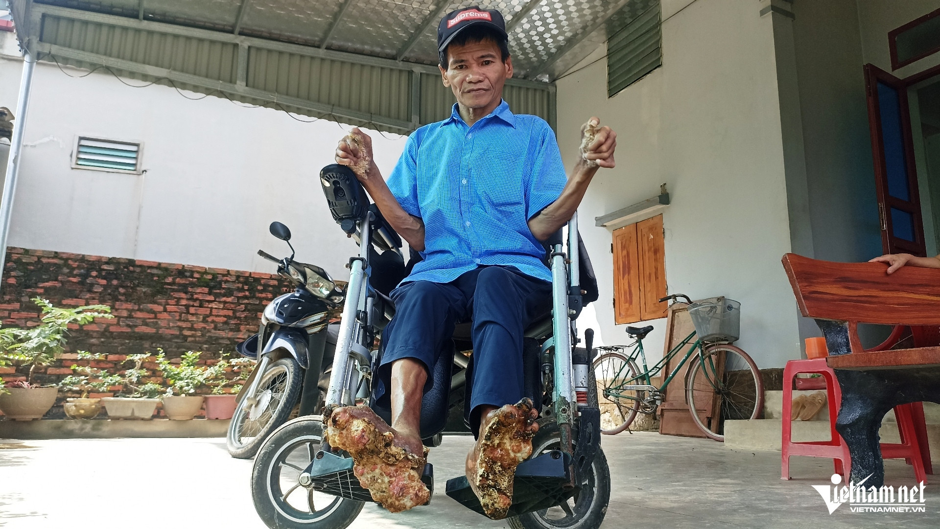 W-Người cây 3.jpg