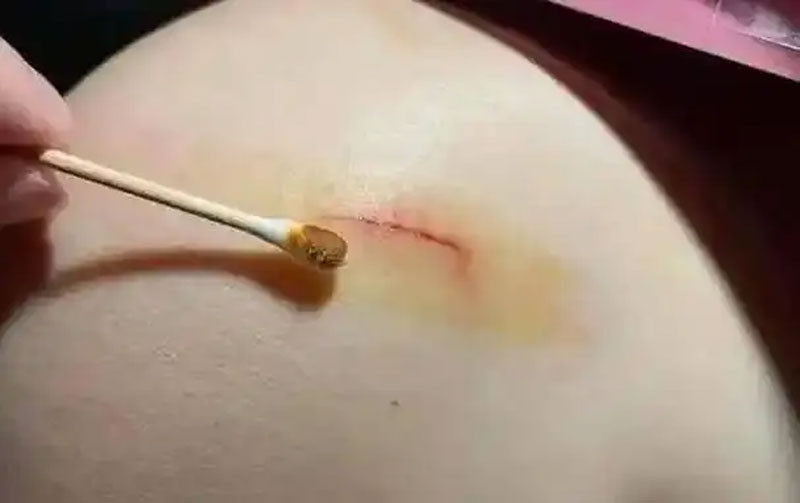 Người thường xuyên ăn móng giò có thể nhận được 4 lợi ích này