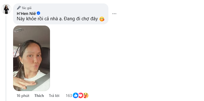 HHen Niê phát hoảng vì mặt sưng phù đến biến dạng chuyện gì đây