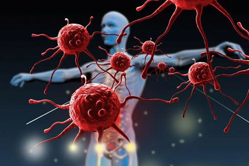 Tại sao ngày càng nhiều người mắc ung thư mặc dù cuộc sống tốt hơn 8 chữ đơn giản vén màn sự thật