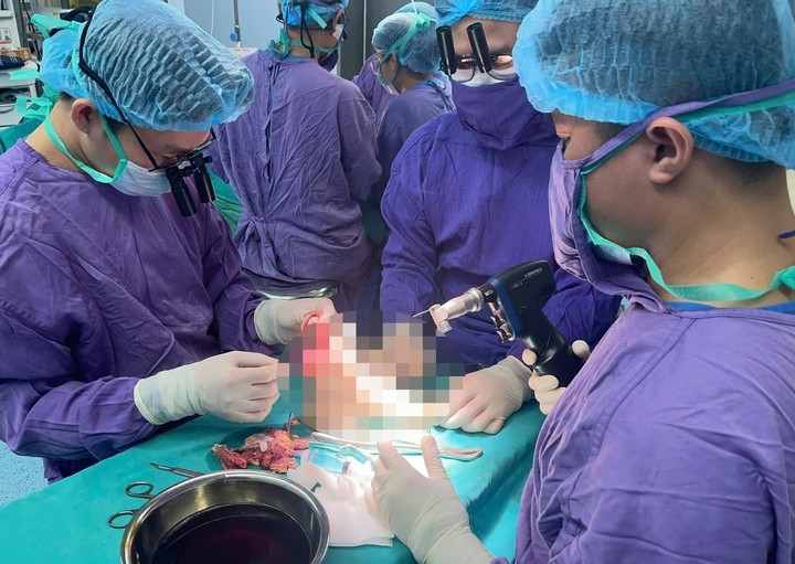 Bác sĩ nối lại chi thể cho bệnh nhân. (Ảnh: BVCC)