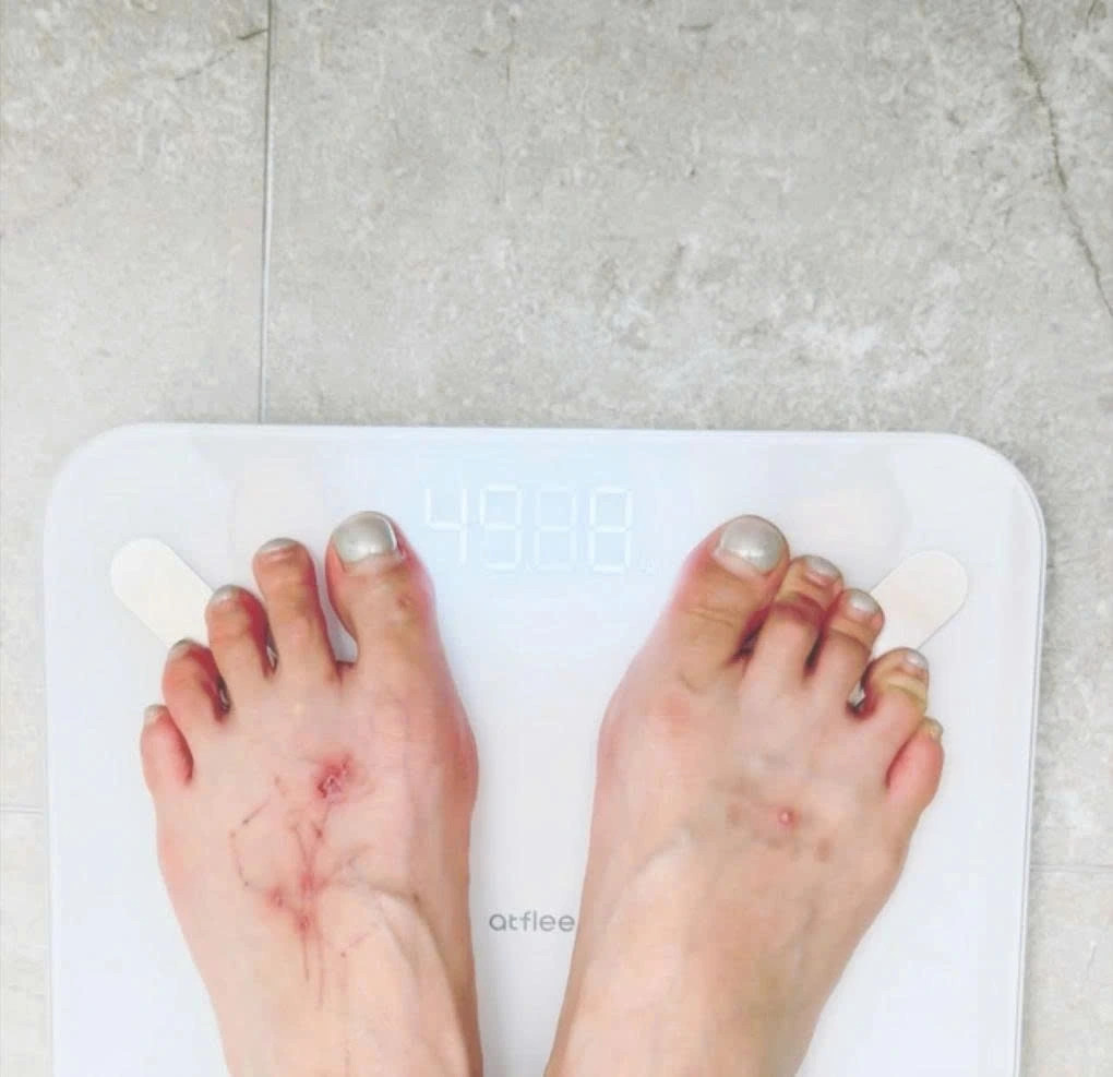 hyuna noi gi sau su co ngat xiu tren san khau hinh anh 2