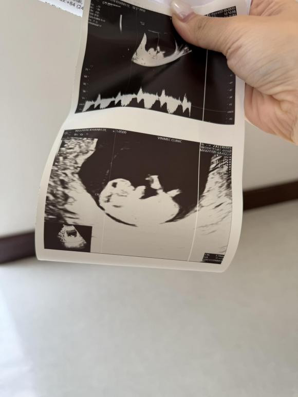 Hôn nhân viên mãn cuộc sống sang chảnh của Ly Kute sau 2 năm kết hôn