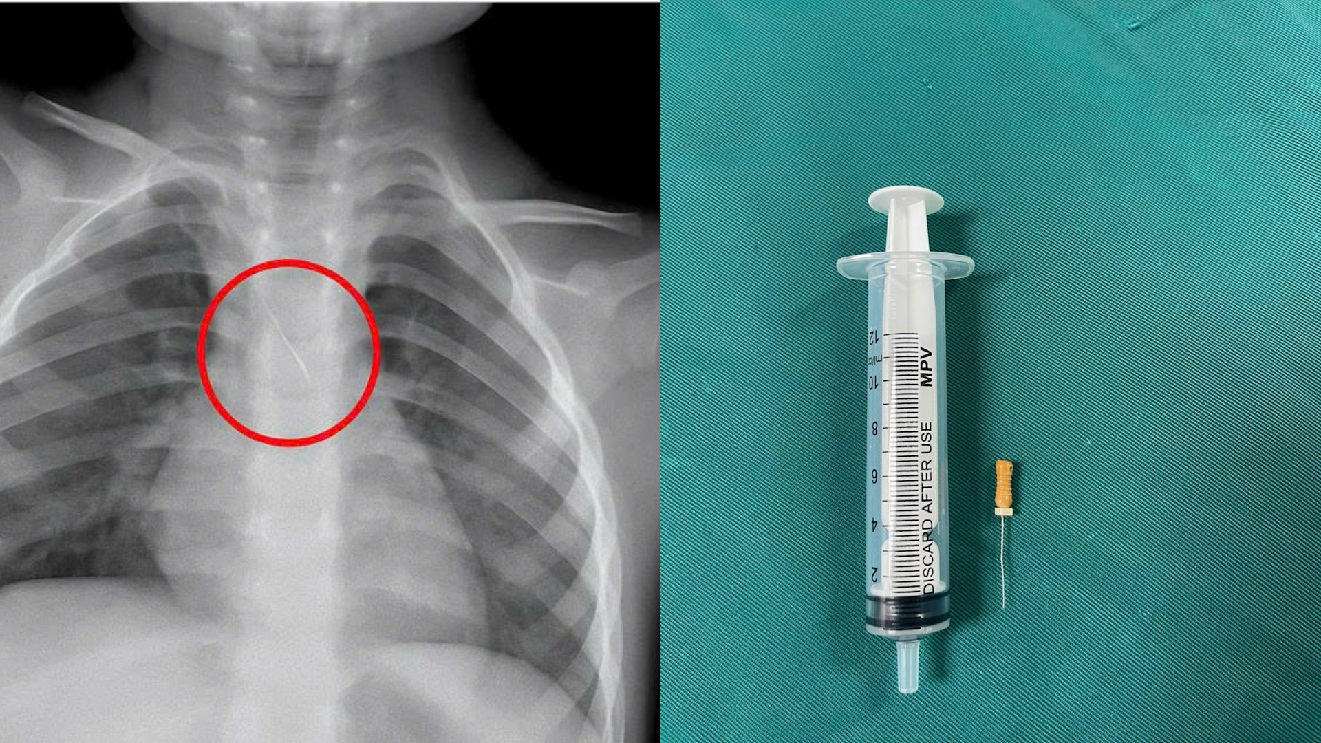 bb72c4fe ea7c 4df1 90c0 66a0697ec964.jpg