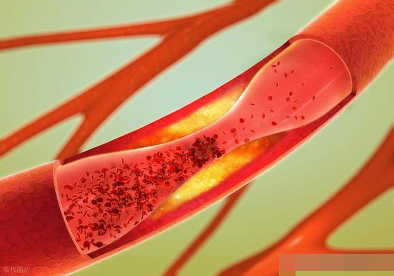 Người có máu sạch thường có 5 đặc điểm nếu đạt được 4 thì xin chúc mừng