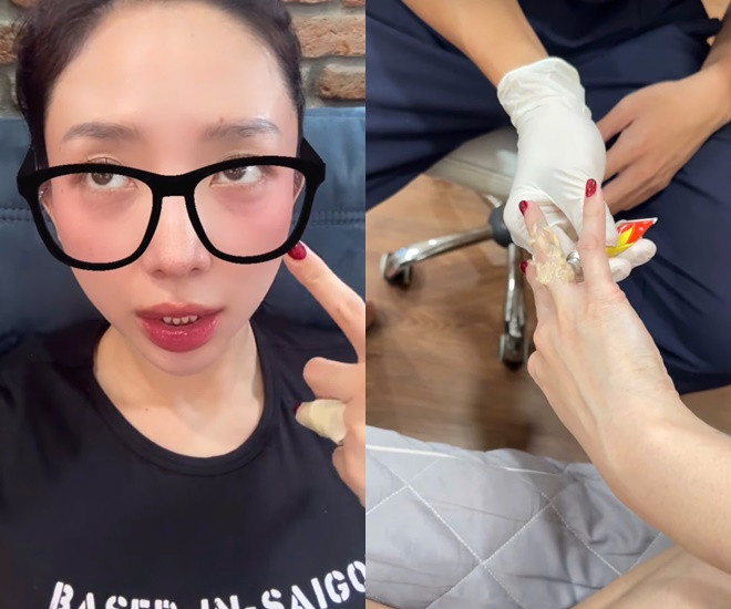 Cận hình xăm đôi 10 năm với người cũ khiến Tóc Tiên cắn răng đi xóa dù đau điếng