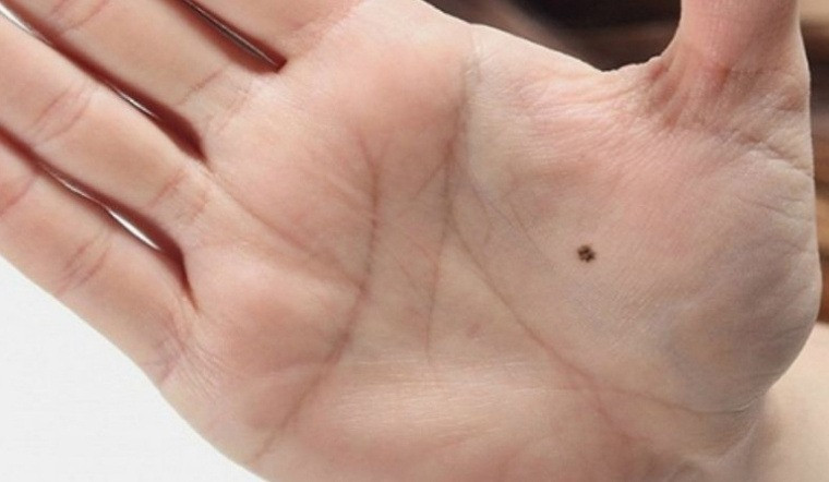 4 vị trí nốt ruồi phú quý, ai sở hữu đều có cuộc đời giàu sang, phúc lộc đủ đầy - Ảnh 1.