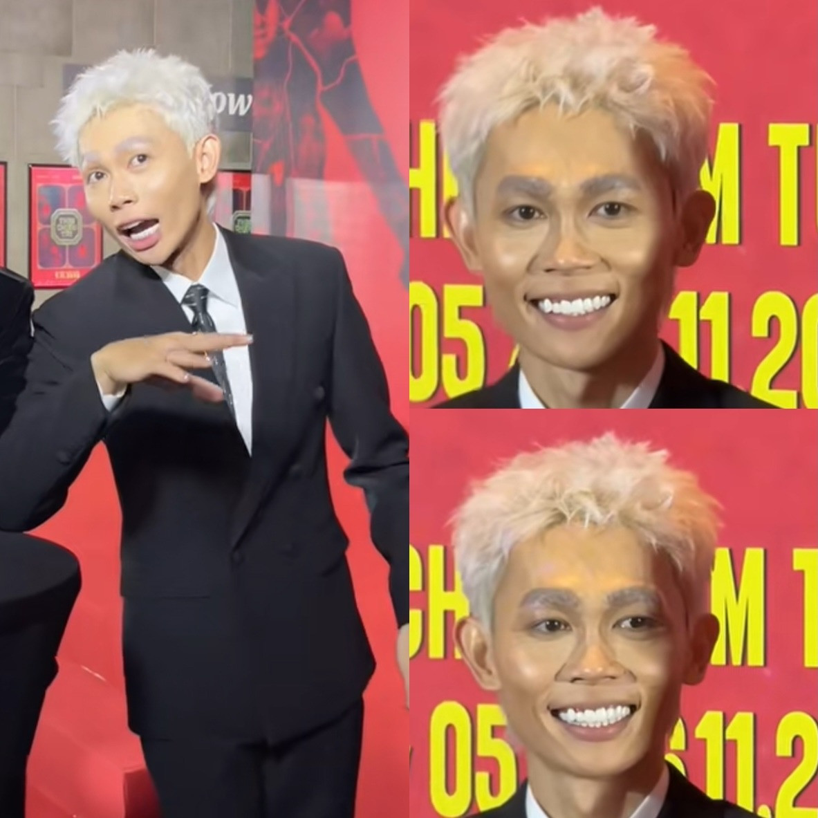 Nam diễn viên Vbiz gây shock với ngoại hình gầy rộc hốc hác không thể nhận ra