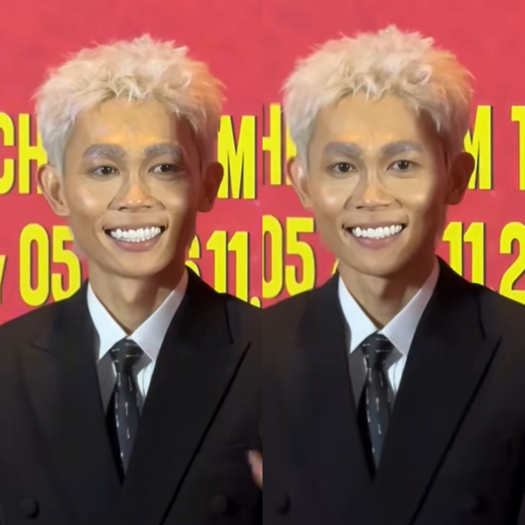 Nam diễn viên Vbiz gây shock với ngoại hình gầy rộc hốc hác không thể nhận ra