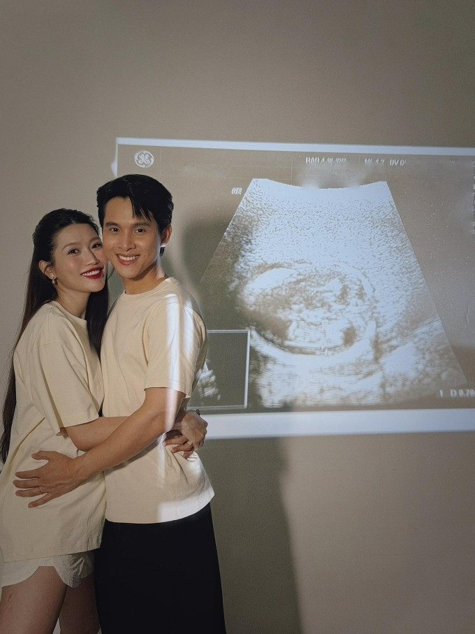 Phản ứng ông xã Á hậu Quỳnh Châu khi biết tin vợ mang  con đầu lòng