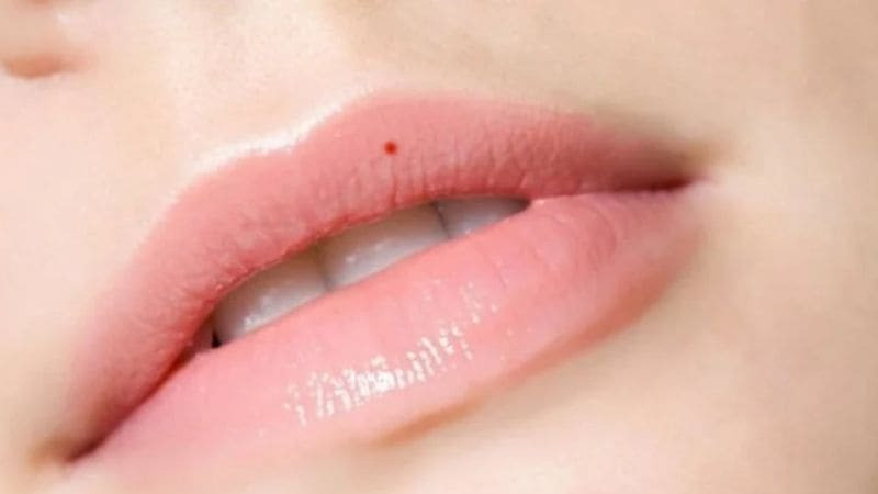 Phụ nữ có nốt ruồi ở vị trí hiếm này: Cả đời hưởng vinh hoa phú quý - Ảnh 1.