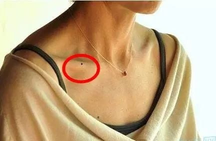 Sở hữu nốt ruồi ở những vị trí này, cuộc sống viên mãn, tình tiền hanh thông - Ảnh 1.