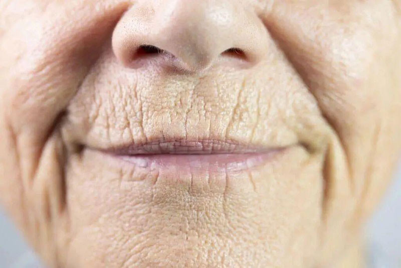 Tắc mạch máu có thể nhận biết qua mặt và chân 6 dấu hiệu không nên bỏ qua