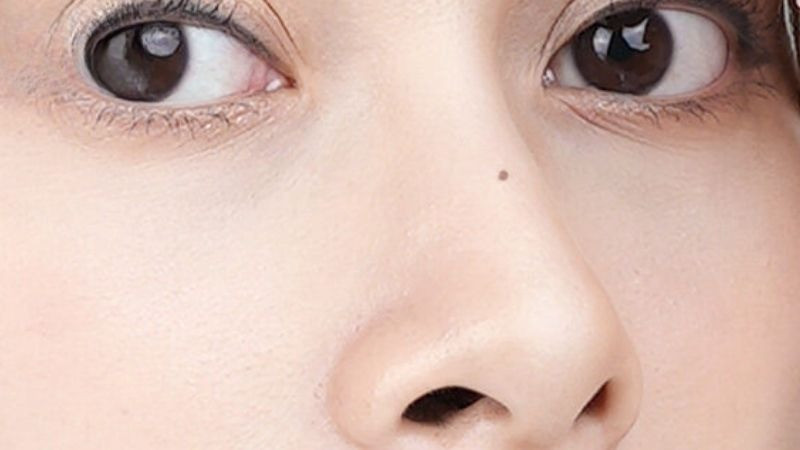 Nhân tướng học chỉ ra: Phụ nữ sở hữu nốt ruồi ở 3 vị trí này thường có số sướng - Ảnh 1.