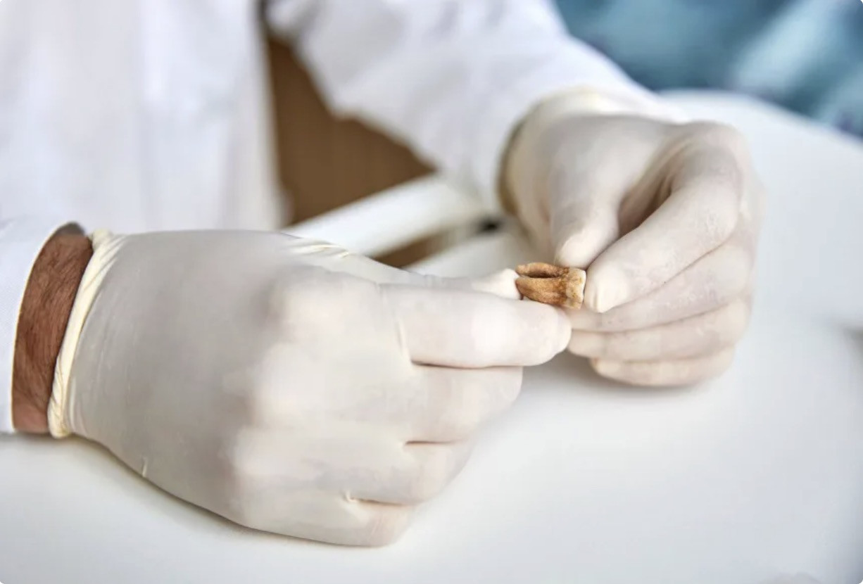 Một chiếc răng được sử dụng để phân tích ADN cổ ​​đại trong quá trình nghiên cứu quân đội của Napoléon. Claudio Centonze/Ủy ban Châu Âu