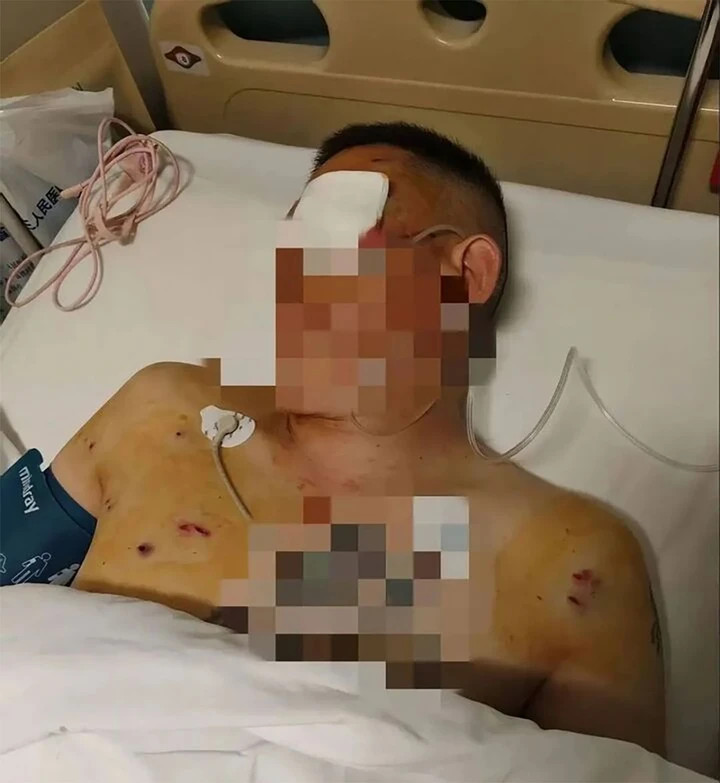 Sau khi rút 1,7 triệu nhân dân tệ, ông Ni bị tên cướp tấn công gây thương tích nặng gay tại lối vào ngân hàng. (Ảnh: Sohu)