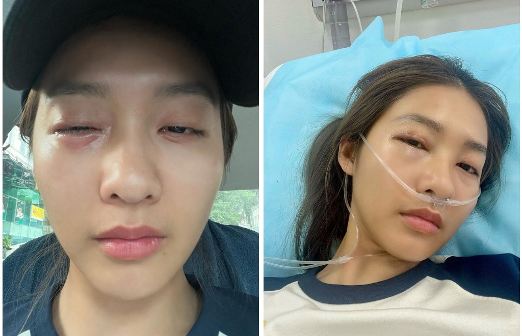 Ngoại hình hiện tại của Khả Ngân sau thời gian liên tục gặp vấn đề sức khỏe