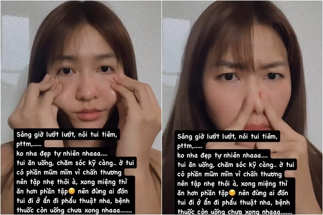 Ngoại hình hiện tại của Khả Ngân sau thời gian liên tục gặp vấn đề sức khỏe