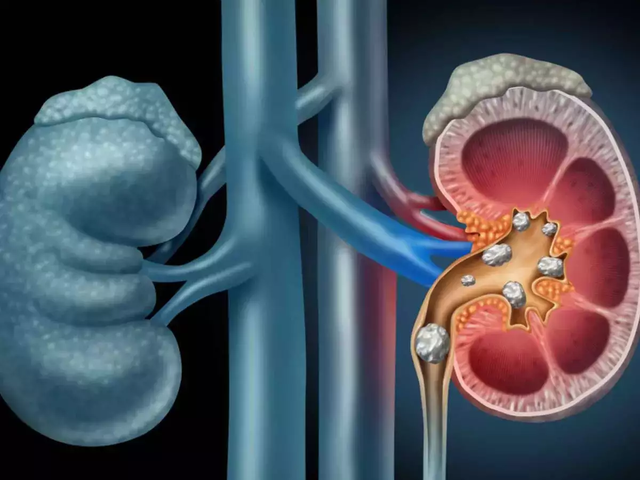 Ăn nhiều món này