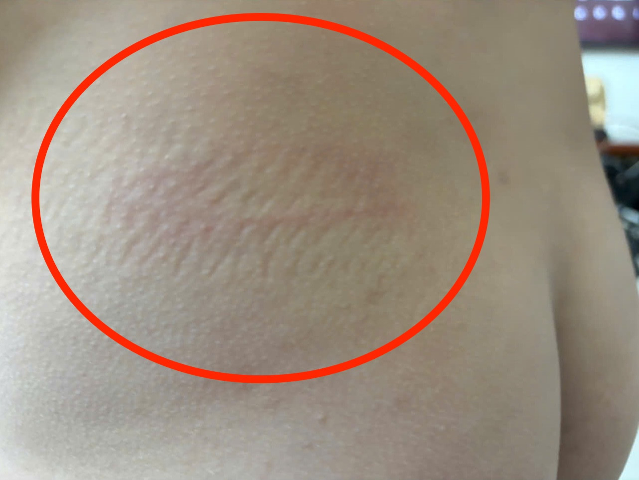 Cô giáo bị tố đánh, xưng