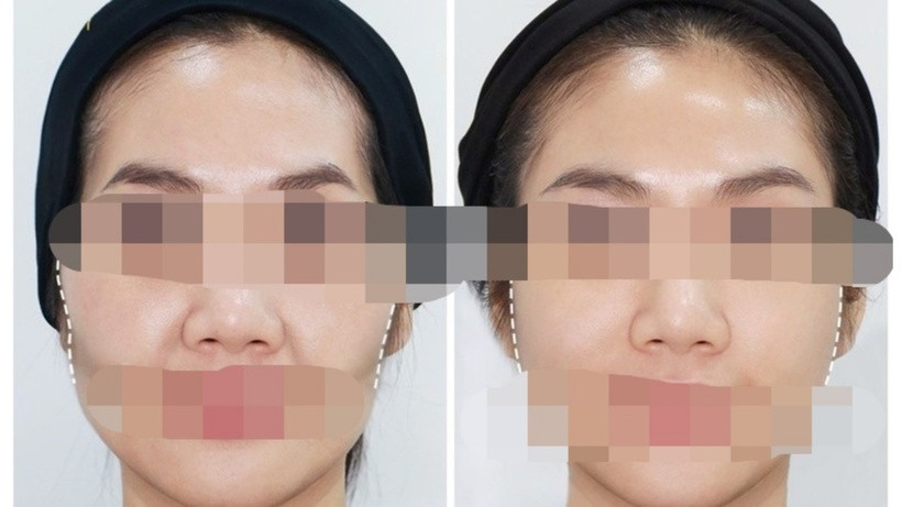 Theo phong thủy, tướng mạo dù thay đổi cũng không cải biến được vận mệnh, gương mặt vẫn biến đổi theo thời gian; dù phẫu thuật nhiều, tướng vẫn thay đổi theo tâm, tâm xấu tướng xấu, tâm thiện tướng thiện. Ảnh minh họa.