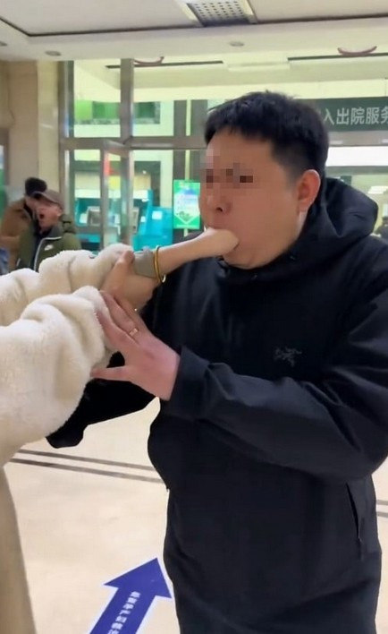 Cô gái mắc kẹt nắm tay theo cách khó ai ngờ tới, bác sĩ mất 20 phút mới gỡ được ảnh 1