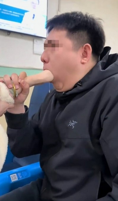 Cô gái mắc kẹt nắm tay theo cách khó ai ngờ tới, bác sĩ mất 20 phút mới gỡ được ảnh 2