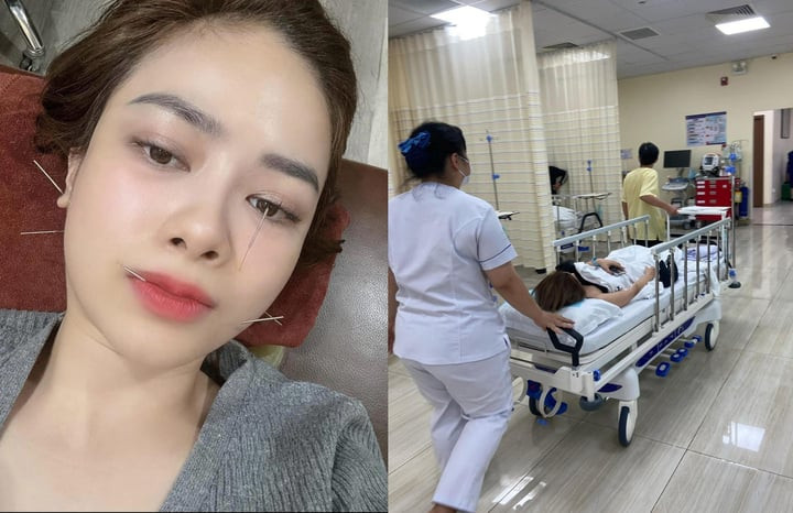 Dương Hoàng Yến bị liệt dây thần kinh số 7 ngoại biên.