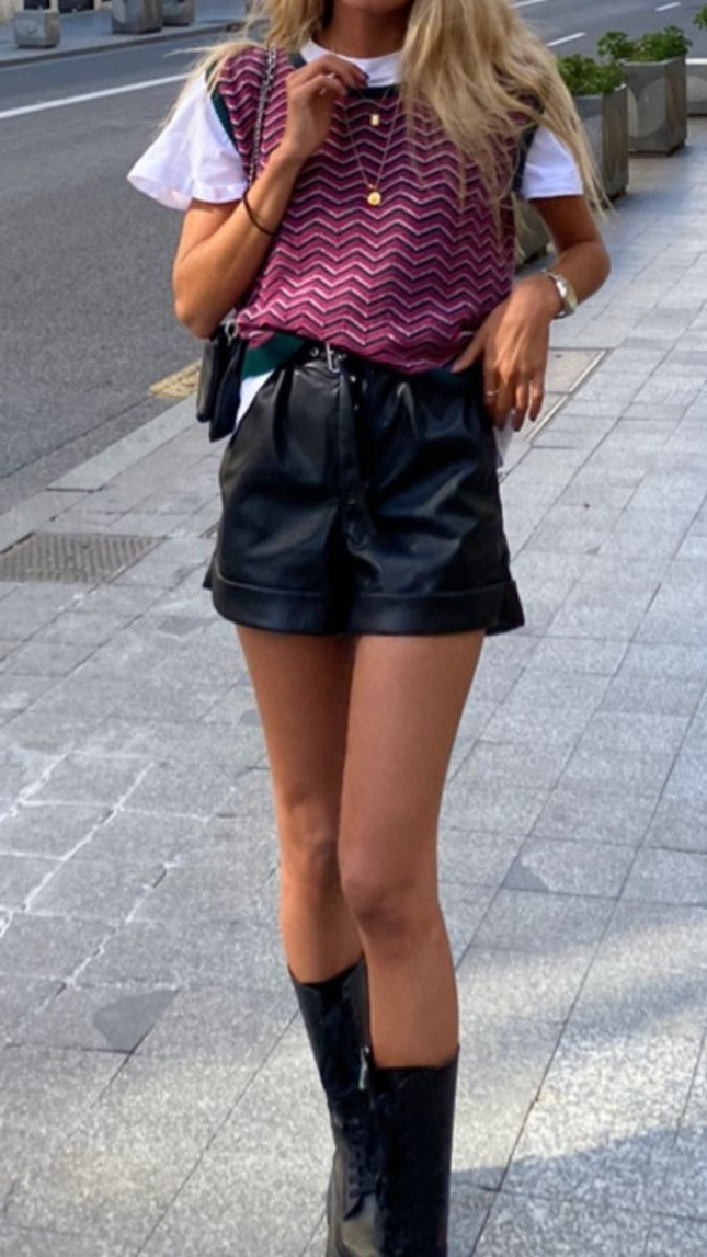 Những phiền phức dễ gặp khi mặc quần soóc và cách khắc phục hiệu quả ảnh 6