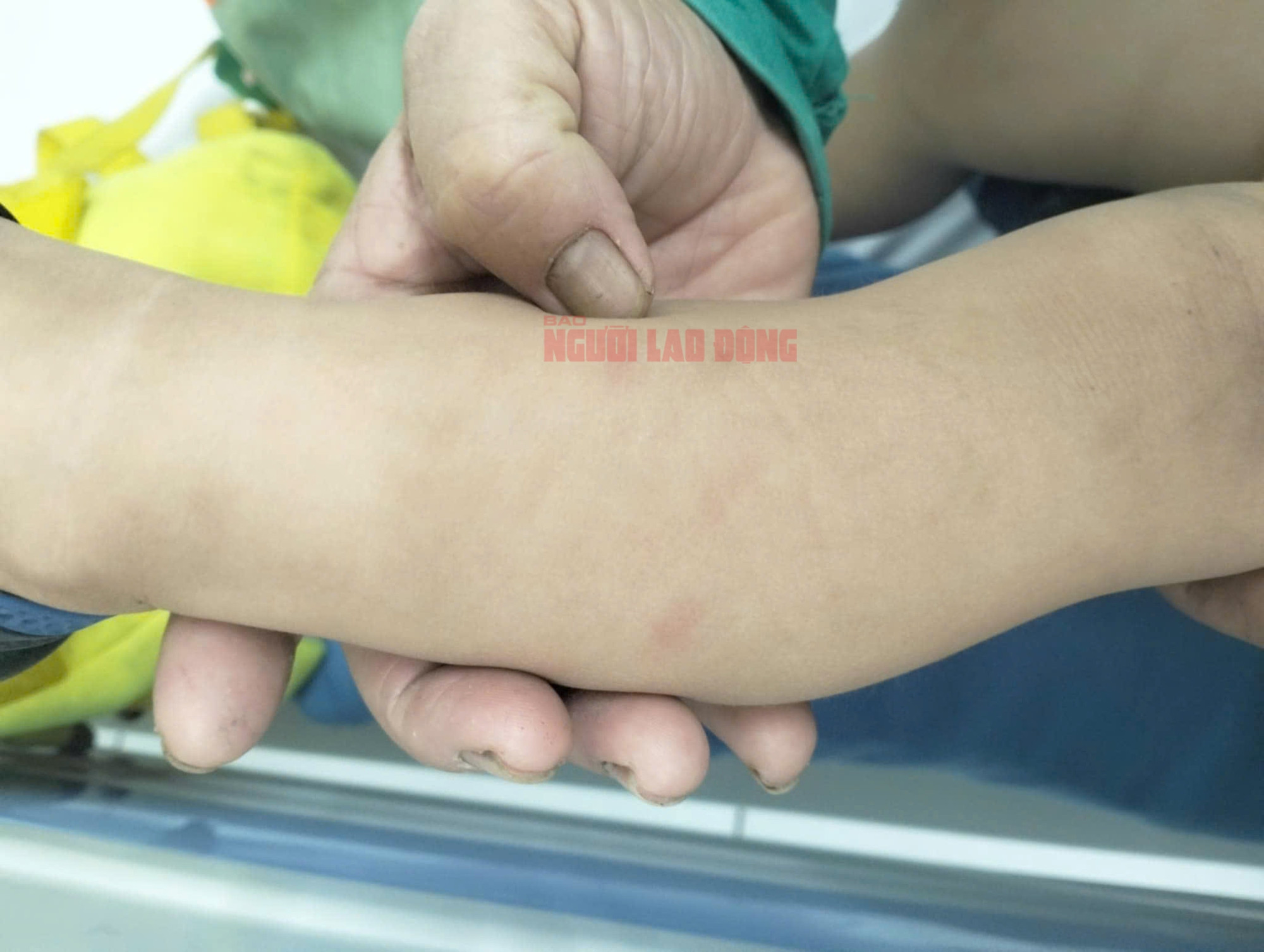 Bảo mẫu đánh trẻ dã man ở Quảng Nam: Quên tắt camera phụ huynh mới phát hiện- Ảnh 3.