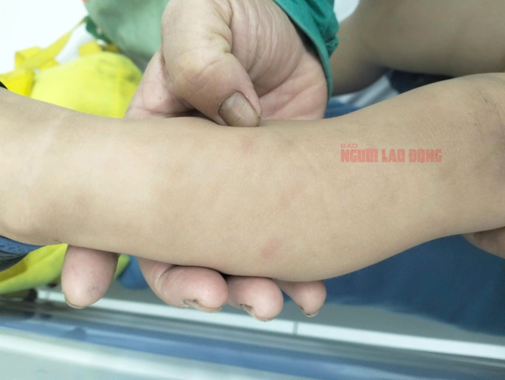 Nữ giáo viên đánh trẻ dã man: Kết quả điều tra ban đầu từ Công an Quảng Nam- Ảnh 4.